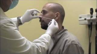 Procedure for Nasopharyngeal Swabs and Aspirates [upl. by Salisbarry]