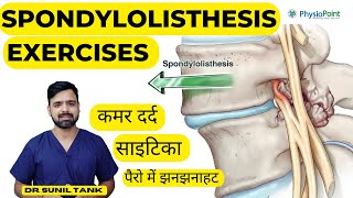 Spondylolisthesis Exercises  Spondylolisthesis physiotherapy treatment  L4L5 L5S1  Sciatica [upl. by Ynot318]