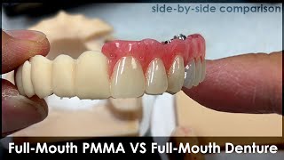 FullMouth Implant PMMA VS Denture Concept  SideBySide Comparison [upl. by Ayikan909]