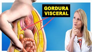 Como Perder Gordura Visceral Rápido  DIMINUA A BARRIGA [upl. by Leahcim]