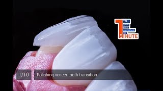 Polishing veneer tooth transition [upl. by Akina]