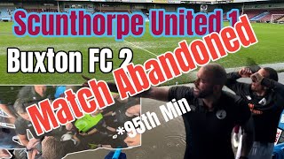 Scunthorpe United AA Buxton FC [upl. by Ezarra311]