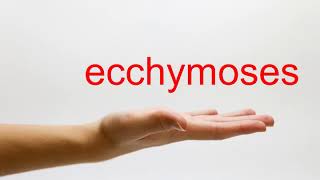 How to Pronounce ecchymoses  American English [upl. by Kimberley116]