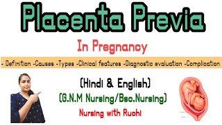 Placenta PreviaPlacenta Previa in pregnancyPlacenta Previa in hindi [upl. by Burrell]