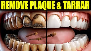 9 Natural Ways to Remove Plaque amp Tartar Buildup [upl. by Ocana]