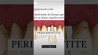 Doença que faz os dentes caírem Periodontite dentesmoles dentista periodontistabrasilia brasil [upl. by Suaeddaht681]