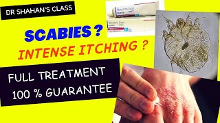 Scabies Treatment  100  sure treatment scabies treatmentplan dermatology [upl. by Cora779]