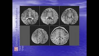 ultrasound radiologysonology [upl. by Tham405]