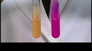 Urease and gelatinase test [upl. by Yrreb]