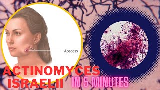 actinomyces microbiology lecture actinomyces israelii Easy Microbiology [upl. by Kciwdahc]