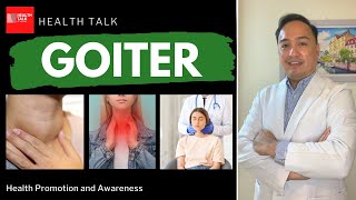 Goiter Symptoms Causes Types Diagnosis and Treatment [upl. by Lierbag390]