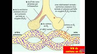 Semiologie de linsuffisance respiratoire Partie 1 [upl. by Tisbee570]