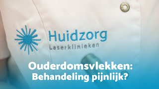 Ouderdomsvlekken verwijderen is de behandeling pijnlijk [upl. by Sims]