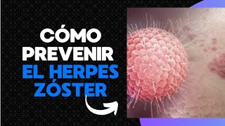 quotCómo prevenir el Herpes Zóster y evitar el dolor crónicoquot [upl. by Nnyletak]