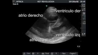 CARDIOPATIA CONGENITA MIXTA [upl. by Goldie]