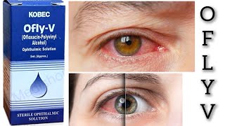 ofly v eye drop uses in urdu Hindi👁️ [upl. by Zigmund372]