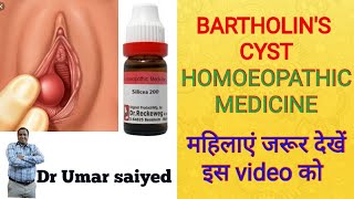 BARTHOLINS CYST TREATMENT [upl. by Eiluj42]