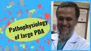 Pathophysiology of Large PDA by Dr Jameel AlAta 24 [upl. by Sair]