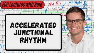 Accelerated Junctional Rhythm  Day 19 ECG Challenge [upl. by Levinson]