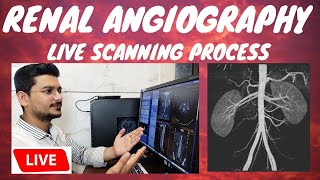 CT RENAL ANGIOGRAPHY LIVE SCAN  Live ct scan of renalabdominal Angiography radiologytechnologist [upl. by Haakon252]