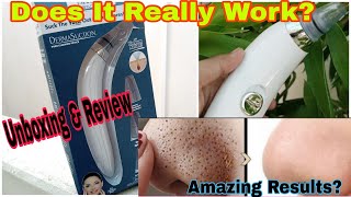 Derma Suction Pore Cleansing Device Review Does It Really Work 🤔 [upl. by Becka]