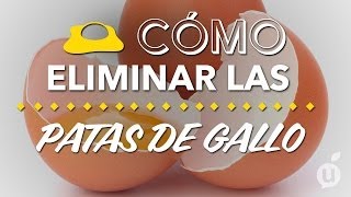 Cómo eliminar las patas de gallo  Cómo quitar las arrugas de los ojos [upl. by Sukcirdor257]