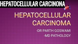 Hepatocellular Carcinoma  HCC Basics [upl. by Zildjian640]