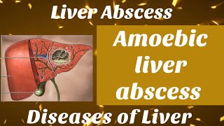 Amoebic liver abscess  in Hindi with notes  liver abscess surgery bamsfinalyear shalyatantra [upl. by Bred461]