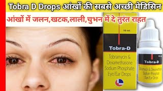 ✅Tobra D Drops आंखों में जलन  खटक  लाली  चुभन  एलर्जी  इन सब में दे तुरंत राहत side effects [upl. by Gilboa]