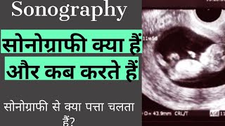 Sonography or ultrasound in hindi  by dr pravin munde [upl. by Acinahs]