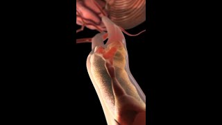 Carotid Arteries Under Attack How Plaque Leads to Stroke medicine anatomy shorts [upl. by Gagliano902]