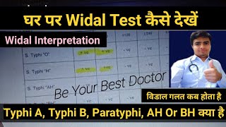 Widal Test In Hindi  विडाल टेस्ट  Widal Test Report Reading In Hindi  Typhoid Fever Test [upl. by Mira222]