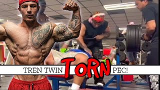 Hate To Say I Told You So  Tren Twins Mikey Torn Pec [upl. by Ciredor315]