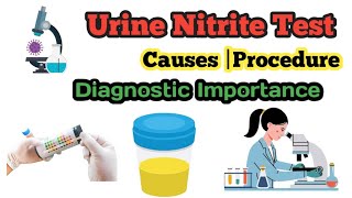 Urine Nitrite Test  Procedure  Diagnostic Importance  Causes [upl. by Enoj]