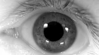 Voluntary Nystagmus with a High Resolution IR Camera Slow Motion [upl. by Yerag]