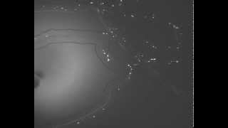 Leukocyte Interaction with Endothelium in SynVivo Microvascular Network [upl. by Rodi]