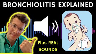 Doctor explains Bronchiolitis RSV with example of REAL SOUNDS  Respiratory syncytial virus [upl. by Aerdua]