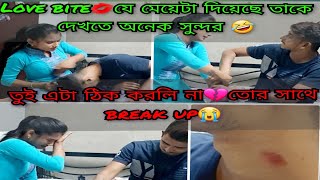 love bite prank on my girlfriendgone wrongrelationship e r thakbo na🤣priyankasstories2233 [upl. by Mueller]