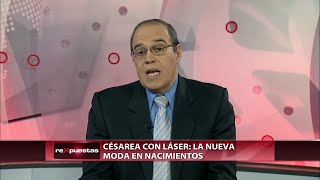 Cesárea con laser La nueva moda [upl. by Elgna]