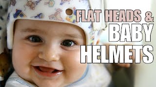 Pediatrician Explains Plagiocephaly Flattening of Head and Helmeting Baby Helmets [upl. by Anedal]