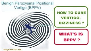 How To Cure VertigoDizziness  What is BPPV [upl. by Parish466]