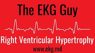 Right Ventricular Hypertrophy on EKG  ECG l The EKG Guy  wwwekgmd [upl. by Arratahs]