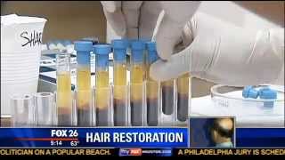 ACell  PRP Stem Cell Hair Regrowth Treatment  Houston Hair Surgeon Dr Dan McGrath [upl. by Korff]