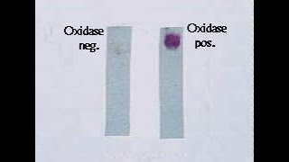 Oxidase Test [upl. by Bishop273]