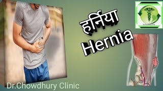 Hernia l हर्निया l Homoeopathic medicines for hernia l [upl. by Idalia]