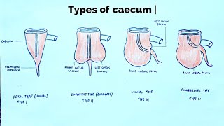 Types of caecum  med tutorials [upl. by Sokram]