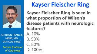 kayserfleischer ring [upl. by Llenoj]