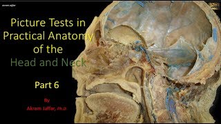 Picture tests in head and neck anatomy 6 [upl. by Irah298]