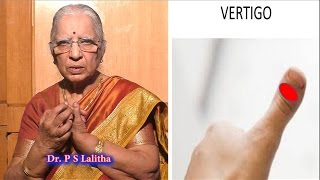 What is Vertigo Treatment  தலை சுற்றல் Headache  Cause of Vertigo  Reiki  DrP S Lalitha [upl. by Alage]