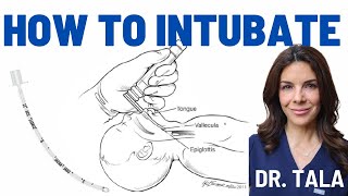 Neonatal intubation made SUPER EASY Stepbystep instructions [upl. by Regine]